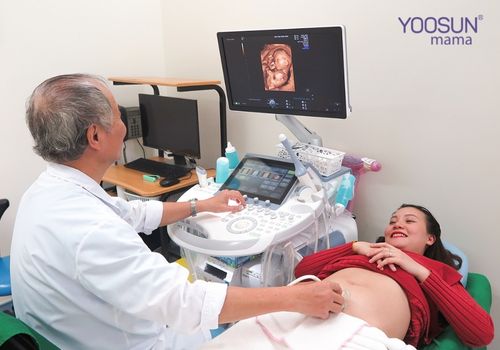 các mốc siêu âm thai 4d quan trọng