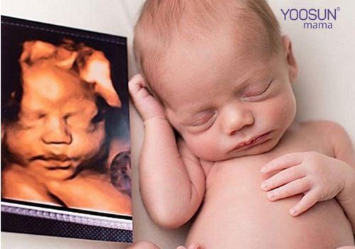 Giá siêu âm 2d bao nhiêu tiền