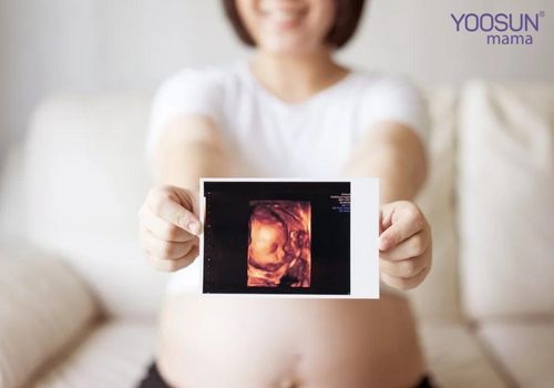 siêu âm 4d có phát hiện bệnh down không