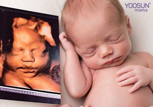 siêu âm 4d là gì