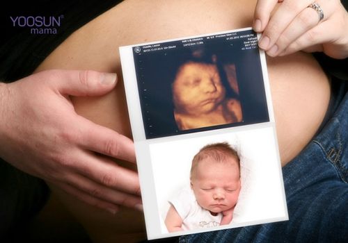 siêu âm 5d có hại không