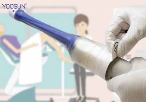 Siêu âm đầu dò là gì