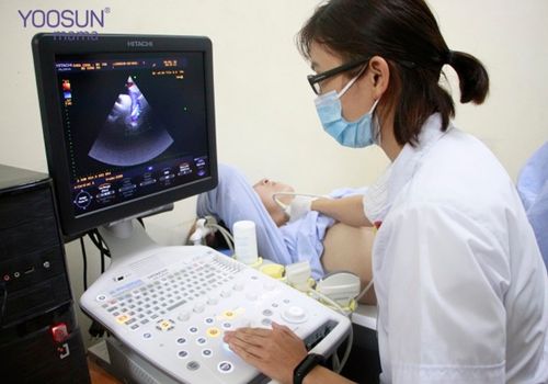 siêu âm doppler là gì