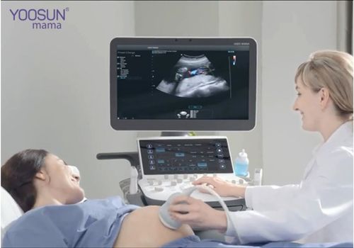 siêu âm doppler thai 36 tuần