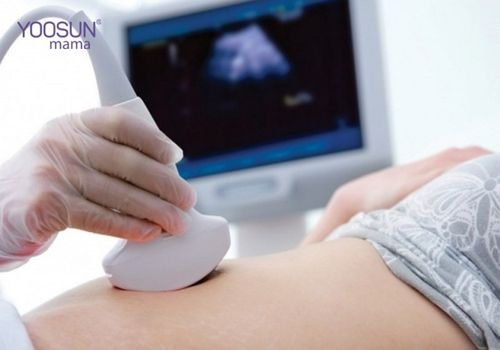 siêu âm thai 2d như thế nào
