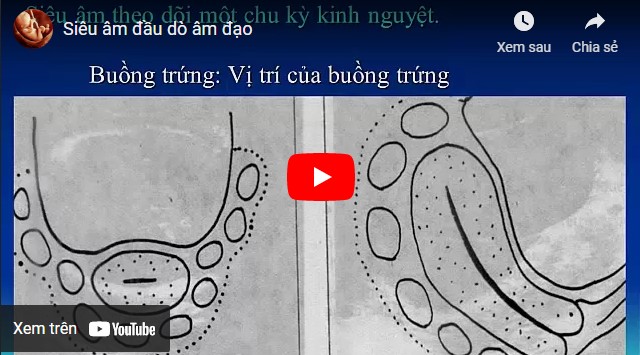 Video siêu âm đầu dò để làm gì