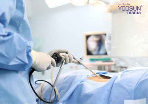 Phẫu thuật cắt dạ dày để giảm cân Cắt dạ dày để giảm cân