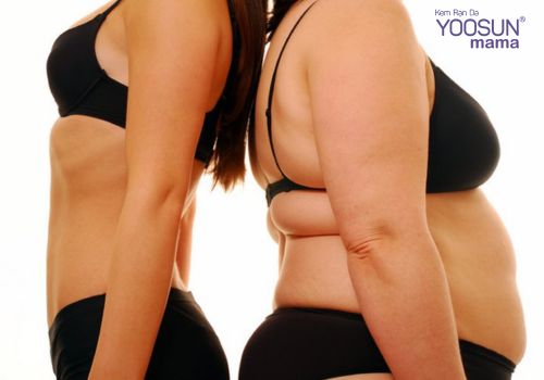 Tiến hành phẫu thuật cắt dạ dày giảm béo Phẫu thuật cắt dạ dày giảm béo