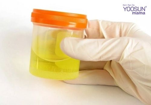 Cách thử thai bằng rượu