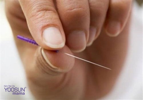 Dùng kim để thử thai