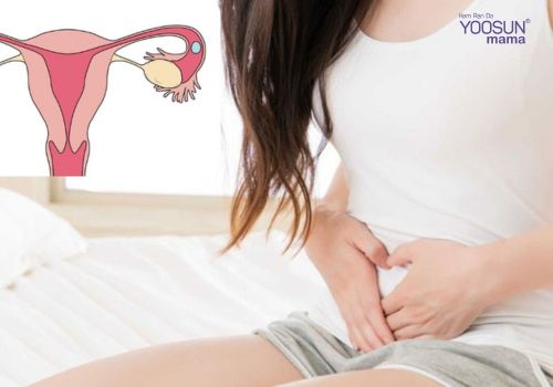 chửa ngoài dạ con có đẻ được không