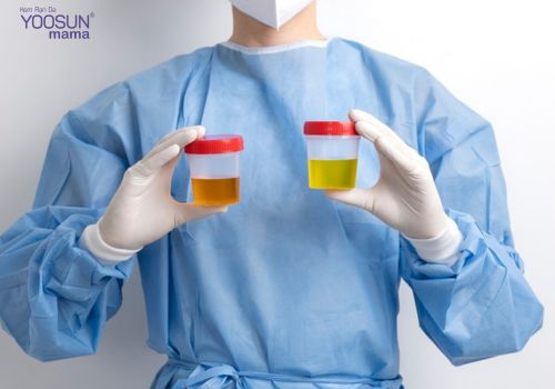 Nghén con trai thèm ăn gì