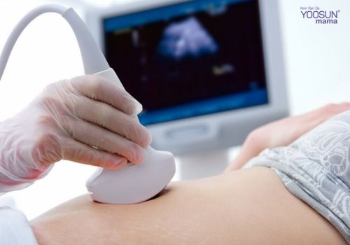 Các dấu hiệu có tim thai sau chuyển phôi