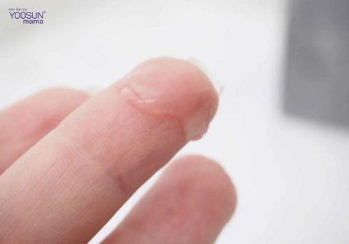 ra khí hư khi mang thai 3 tháng đầu