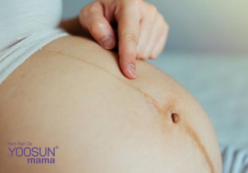 Dấu hiệu mang thai ở bụng