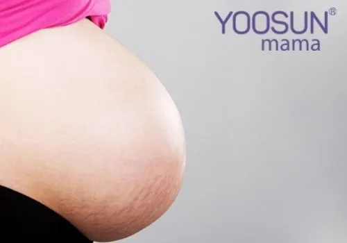 Hình ảnh rạn da khi mang thai