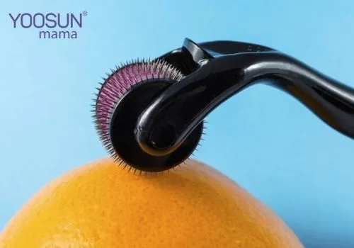 Cách lăn kim trị rạn da bụng