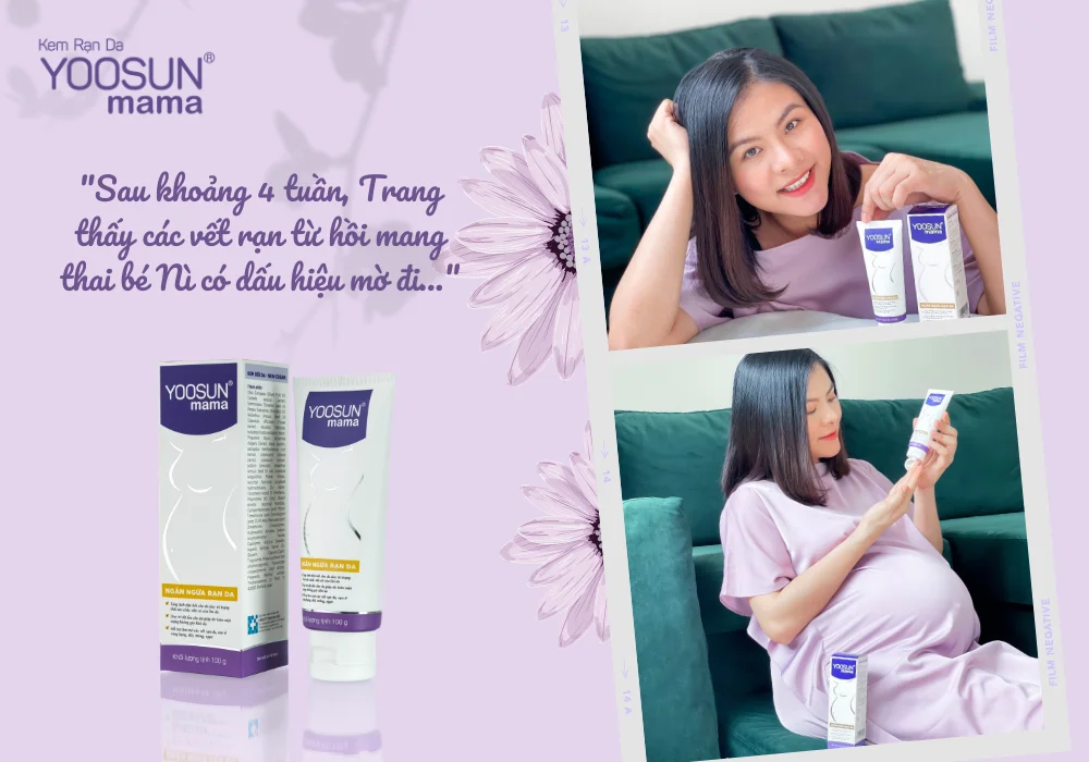 Diễn viên Vân Trang dùng kem rạn da yoosun mama